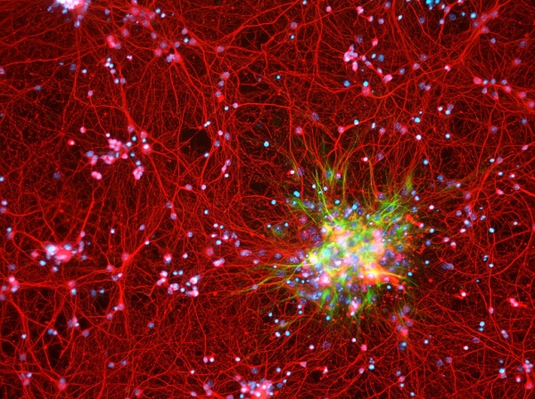 ▲ 뇌 안에 있는 별 모양의 성상세포 [사진 출처=wikipedia]