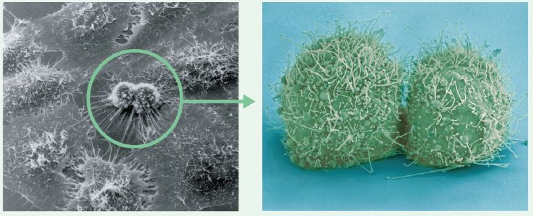 주사전자현미경으로 본 분열 중인 헬라세포의 모습(왼쪽)과 분열 직후의 헬라세포(오른쪽) [출처=wikipedia]